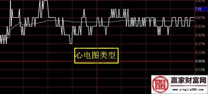 心電圖類型走勢圖